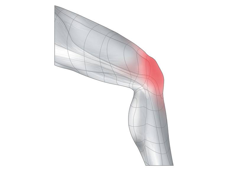 Ga naar volledige schermweergave: sensiplast® Kniegewrichtbandage - afbeelding 4